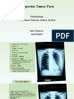 Ekspertise Tumor Paru