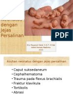 Neonatus Dengan Jejas Persalinan