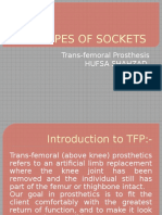 Types of Sockets: Trans-Femoral Prosthesis Hufsa Shahzad