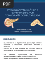 Pancreas SSRR TC