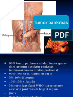 CA Pancreas