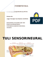 Tuli Sensorineural