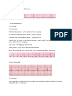 Aritmia EKG Dengan Kriterianya