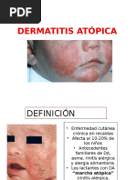 Dermatitis Atópica y Seborreica