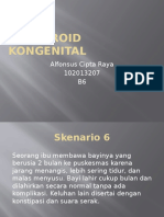 Hipotiroid Kongenital