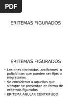 Eritemas Figurados