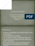  Gynecomastia