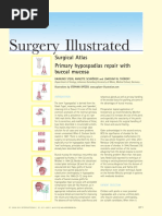 Surgical Atlas Primary Hypospadias Repair With Buccal Mucosa