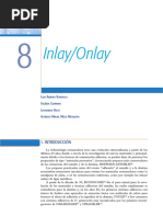 Inlay - Onlay Espanhol