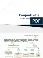 Conjuntivitis