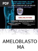 Ameloblastoma