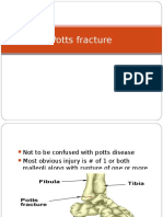 Potts Fracture