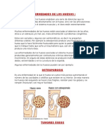 Enfermedades de Los Huesos