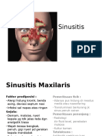 Sinusitis