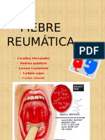 Fiebre Reumática