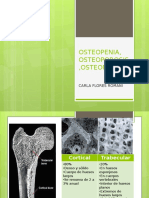 Osteopenia, Osteoporosis y Osteomalacia