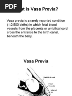 Vasa Previa - Antenatal Hemorrhage, Pregnancy