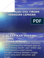 Klasifikasi Gigi Tiruan Sebagian Lepasan