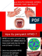 HFMD