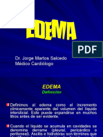 Edema