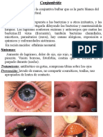 Conjuntivitis - Nâ 8 1