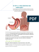 Para Qué Sirve y Cómo Funciona Una Endoscopia EXPLICACION