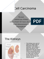 Renal Cell Carcinoma