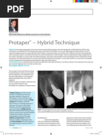 Protaper - Hybrid Tech New