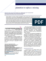 Premolar Transplantation To Replace A Missing Central Incisor