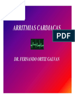 Arritmia Cardiaca