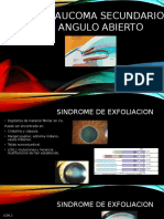 Glaucoma Secundario 