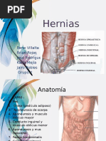 Presentacion Hernias 