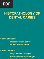 12-Histopathology of Dental Caries