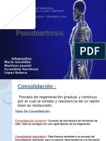 Pseudoartrosis Seminario123