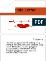 Aritmia Lethal