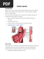 Colon Cancer: Ulcerative Colitis Crohn's Disease