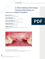 Soft Tissues Remodeling Technique As A N PDF