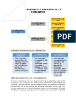 Tumores Benignos y Malignos de La Conjuntiva