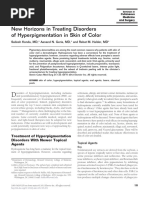 Treating Melasma