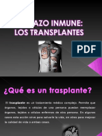 Rechazo de Trasplante