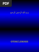 Otosclerosis