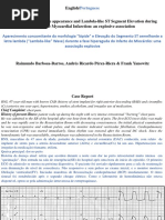 Concomitant Tombostone Appearance and Lambda Like ST Segment Elevation During Hyper Acute MI