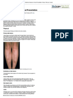 Erythema Nodosum Clinical Presentation - History, Physical, Causes