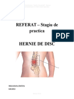 Hernia de Disc