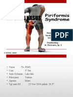 Piriformis Syndrome