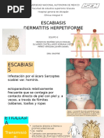 ESCABIASIS