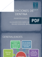 Alteraciones de Dentina