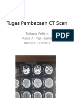 Pembacaan CT Scan