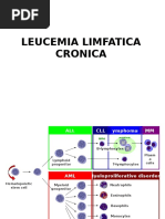 Leucemia Limfatica Cronica