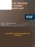 How The Process of Kidney Transplant